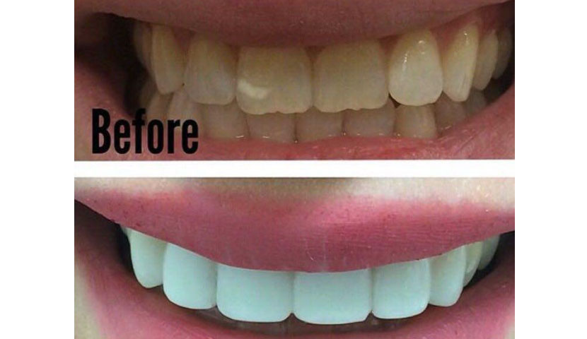 تصویر قبل و بعد کلینیک دندانپزشکی دردیس در سعادت آباد